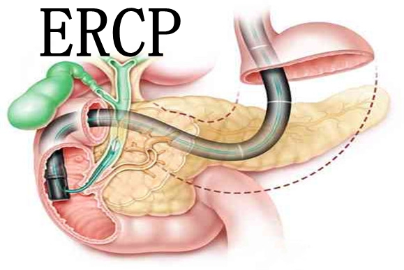 ERCP機(jī)房輻射防護(hù)建設(shè)要求與注意事項(xiàng)